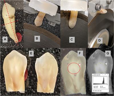 Effect of Temperature on Tooth Staining by 0.12% Chlorhexidine Gluconate